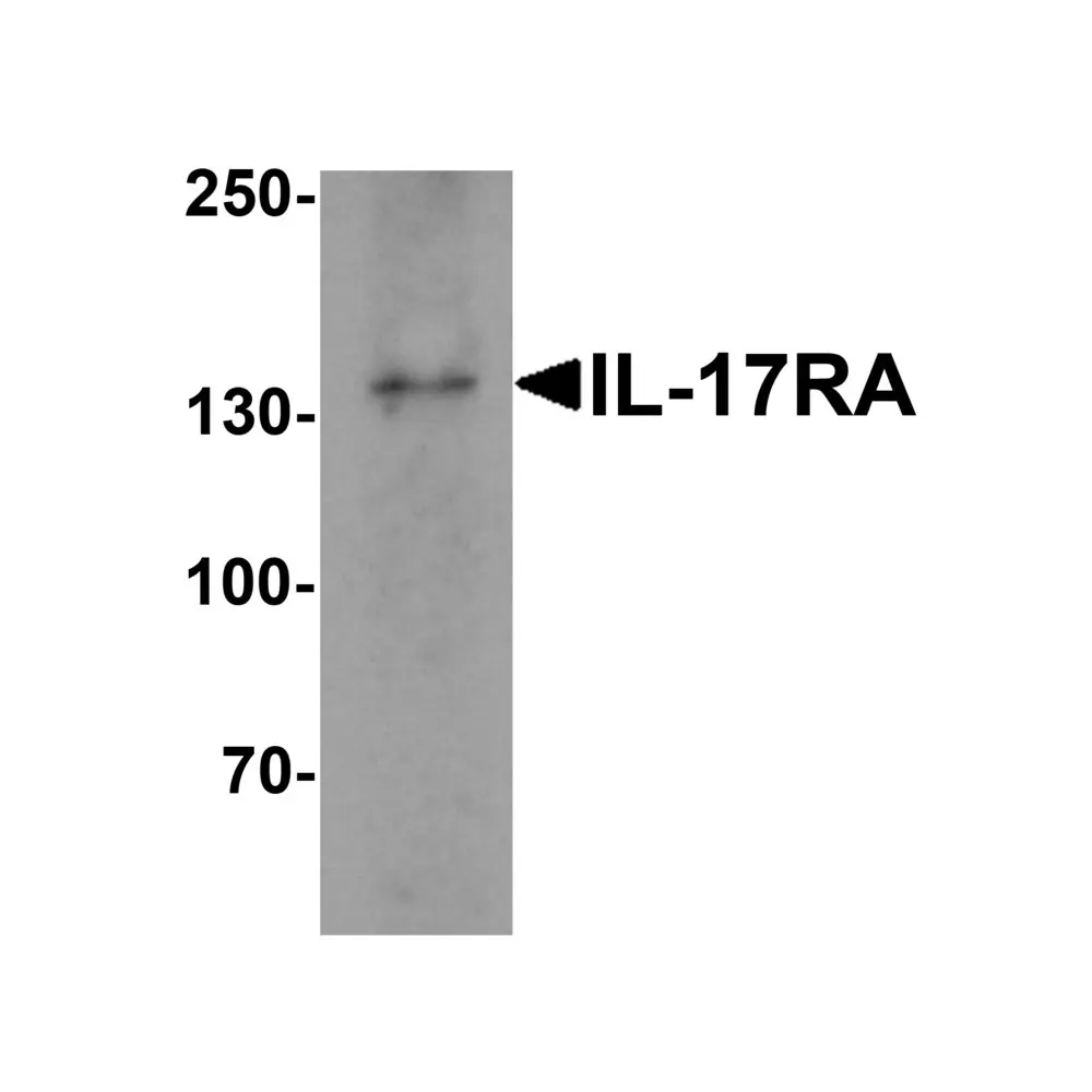 ProSci 7419 IL-17RA Antibody, ProSci, 0.1 mg/Unit Primary Image