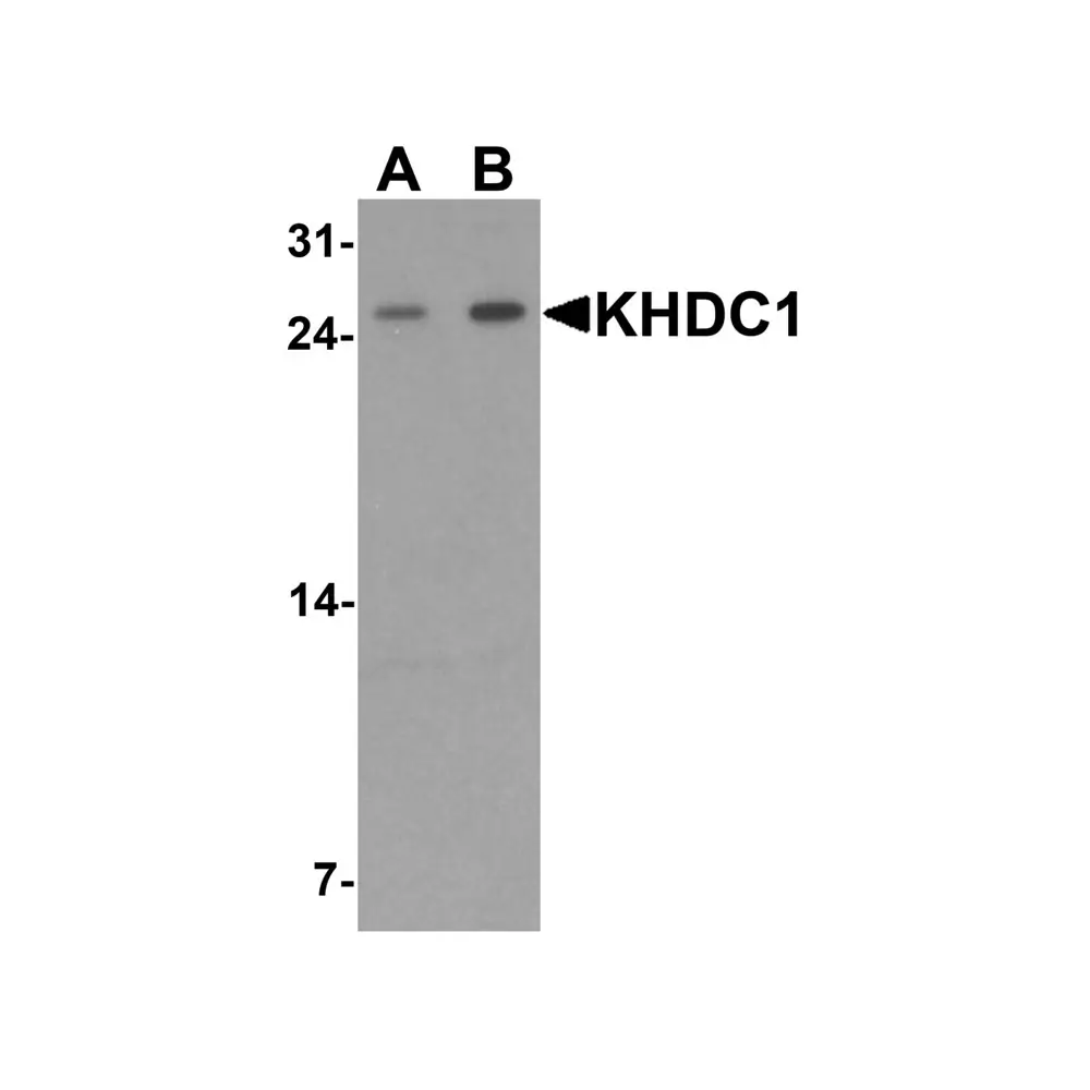 ProSci 7423 KHDC1 Antibody, ProSci, 0.1 mg/Unit Primary Image