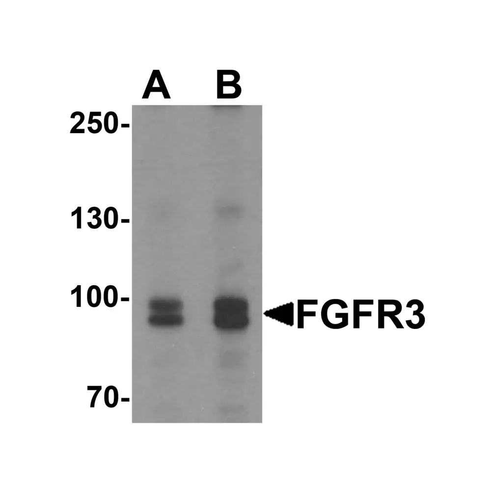 ProSci 7425 FGFR3 Antibody, ProSci, 0.1 mg/Unit Primary Image