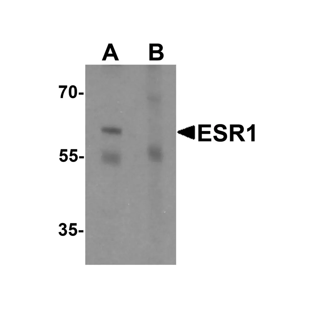 ProSci 7437 ESR1 Antibody, ProSci, 0.1 mg/Unit Primary Image