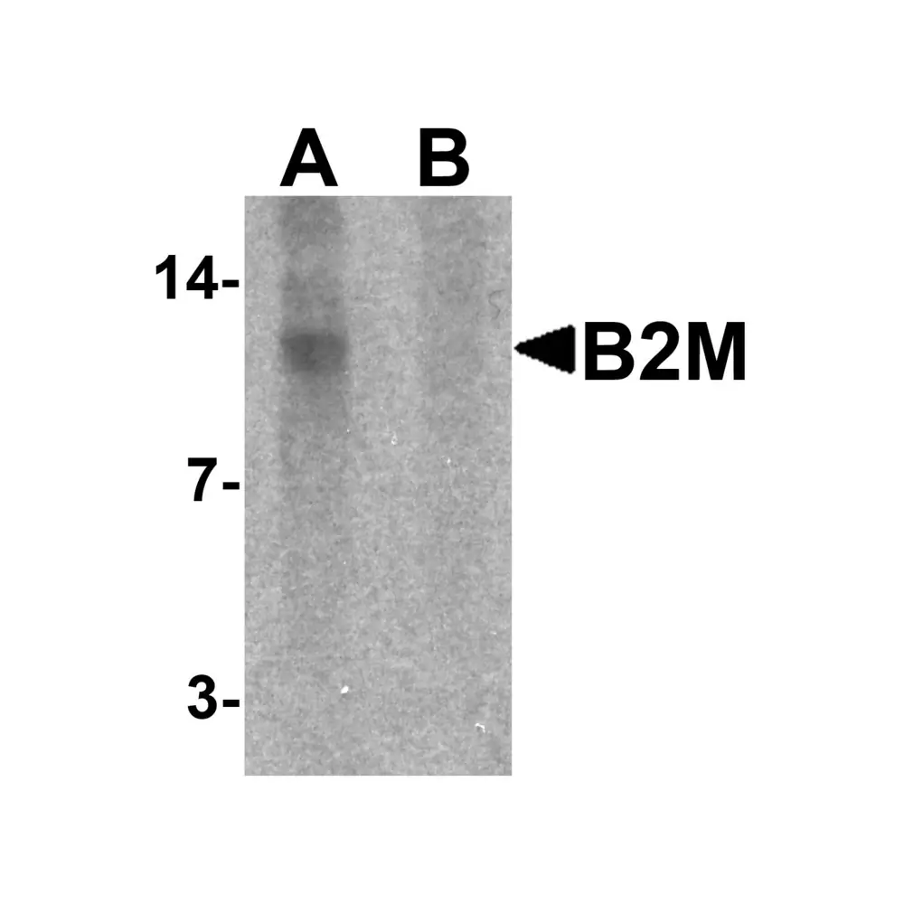 ProSci 7439 B2M Antibody, ProSci, 0.1 mg/Unit Primary Image