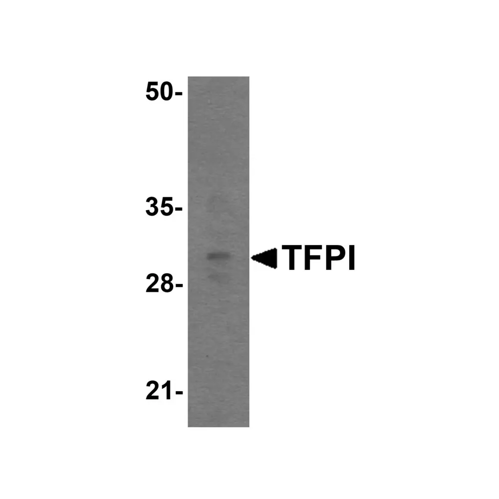 ProSci 7441_S TFPI Antibody, ProSci, 0.02 mg/Unit Primary Image