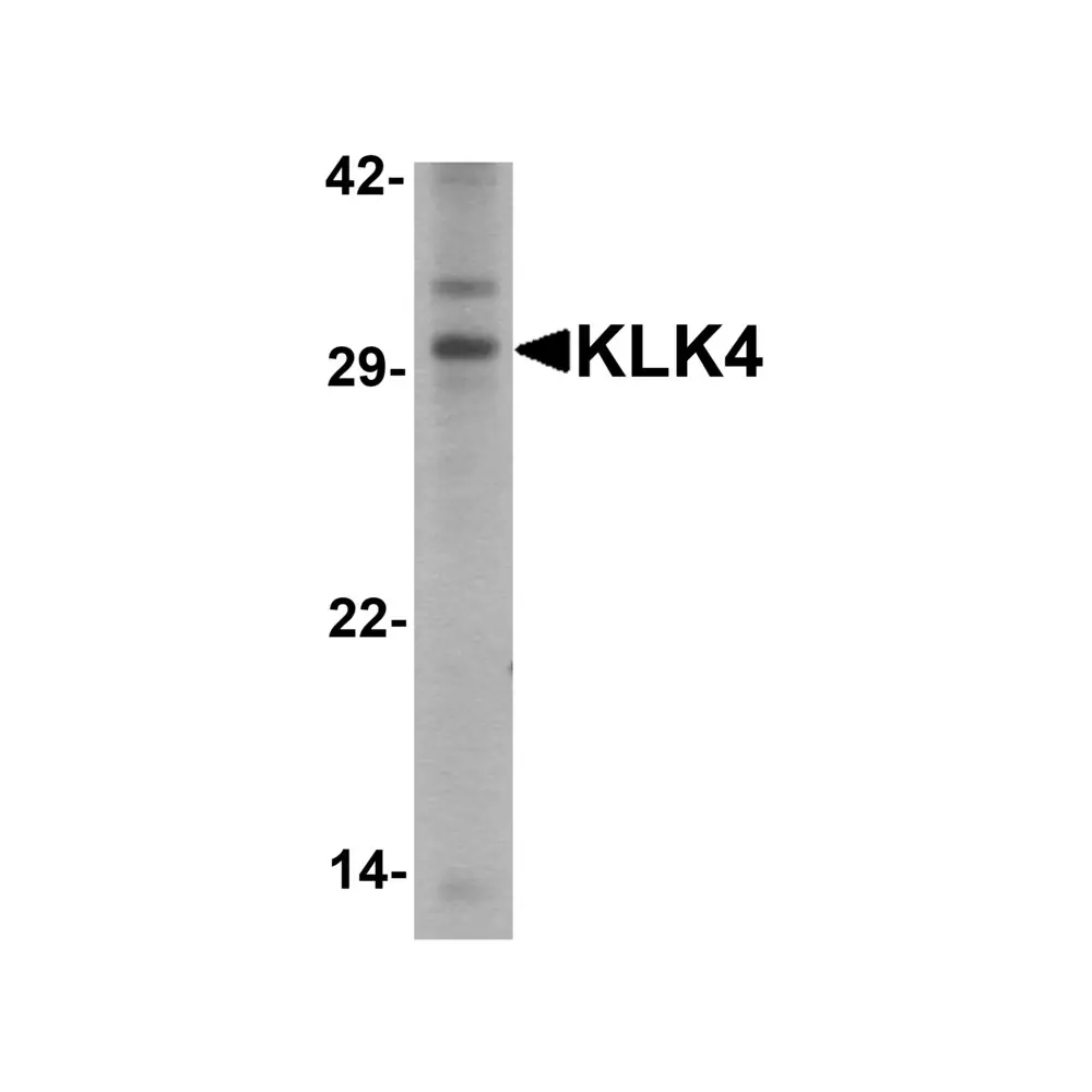 ProSci 7445 KLK4 Antibody , ProSci, 0.1 mg/Unit Primary Image