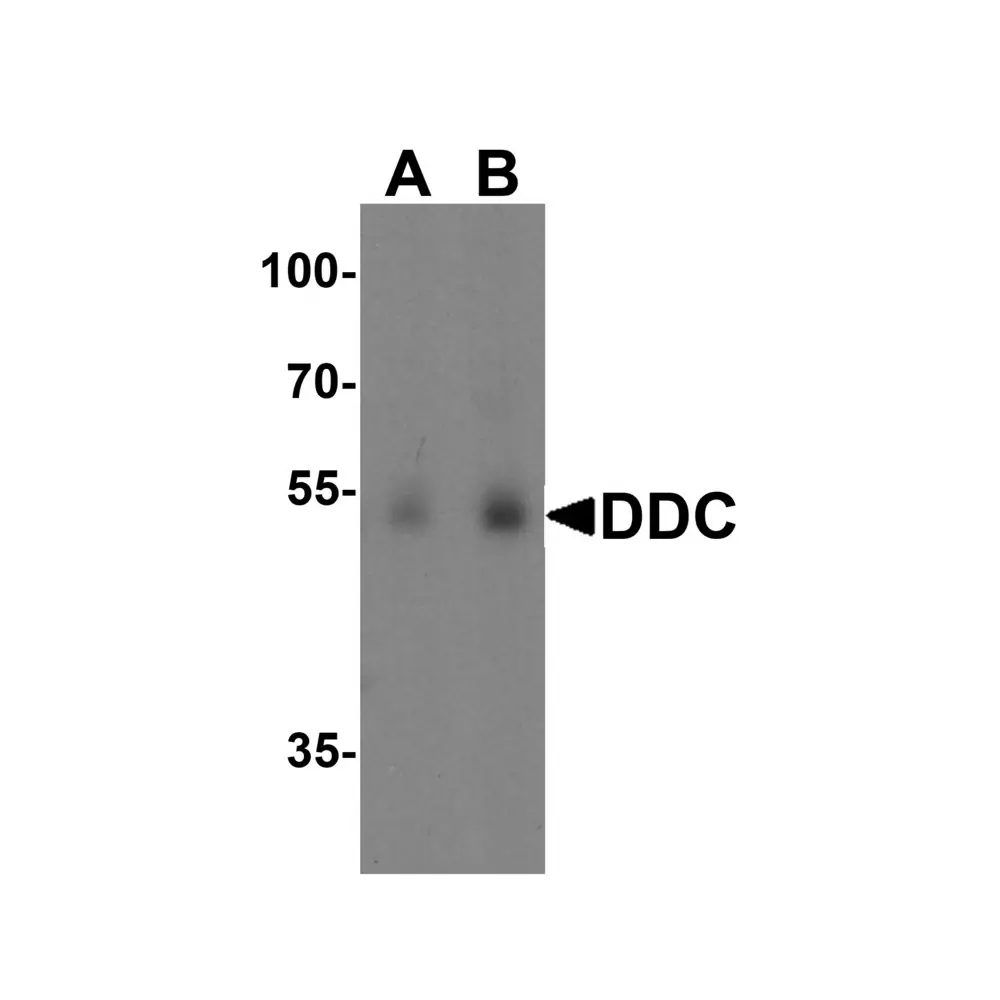ProSci 7447_S DDC Antibody , ProSci, 0.02 mg/Unit Primary Image