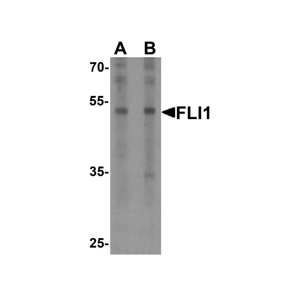 ProSci 7449 FLI1 Antibody , ProSci, 0.1 mg/Unit Primary Image