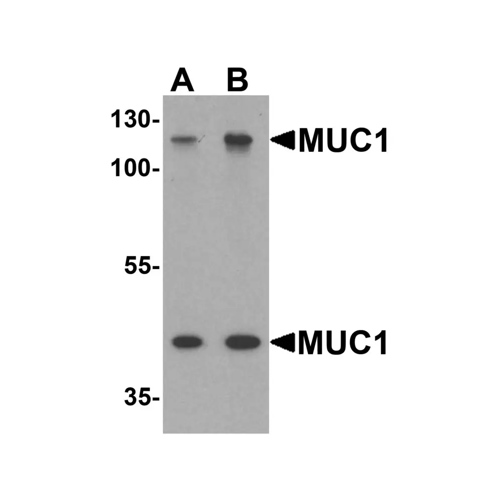ProSci 7451_S MUC1 Antibody , ProSci, 0.02 mg/Unit Primary Image