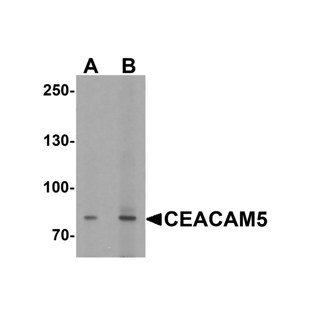 ProSci 7453 CEACAM5 Antibody , ProSci, 0.1 mg/Unit Primary Image