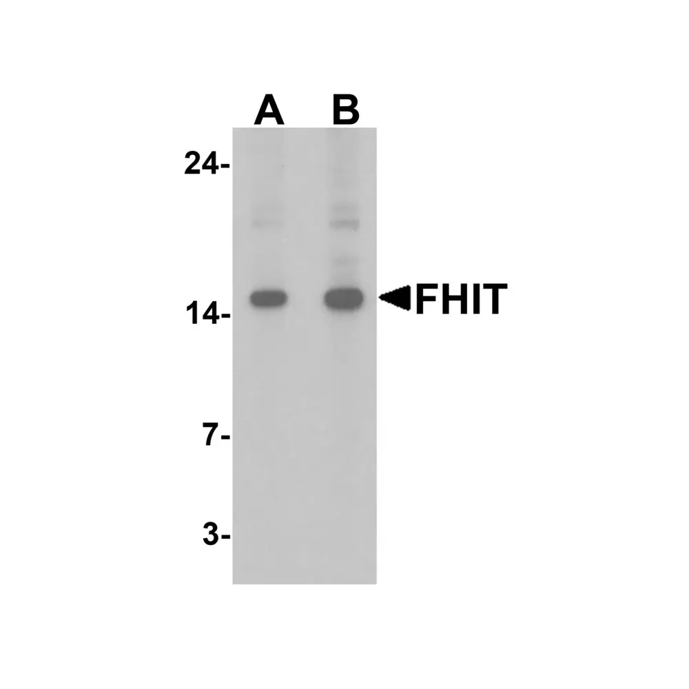 ProSci 7455_S FHIT Antibody , ProSci, 0.02 mg/Unit Primary Image