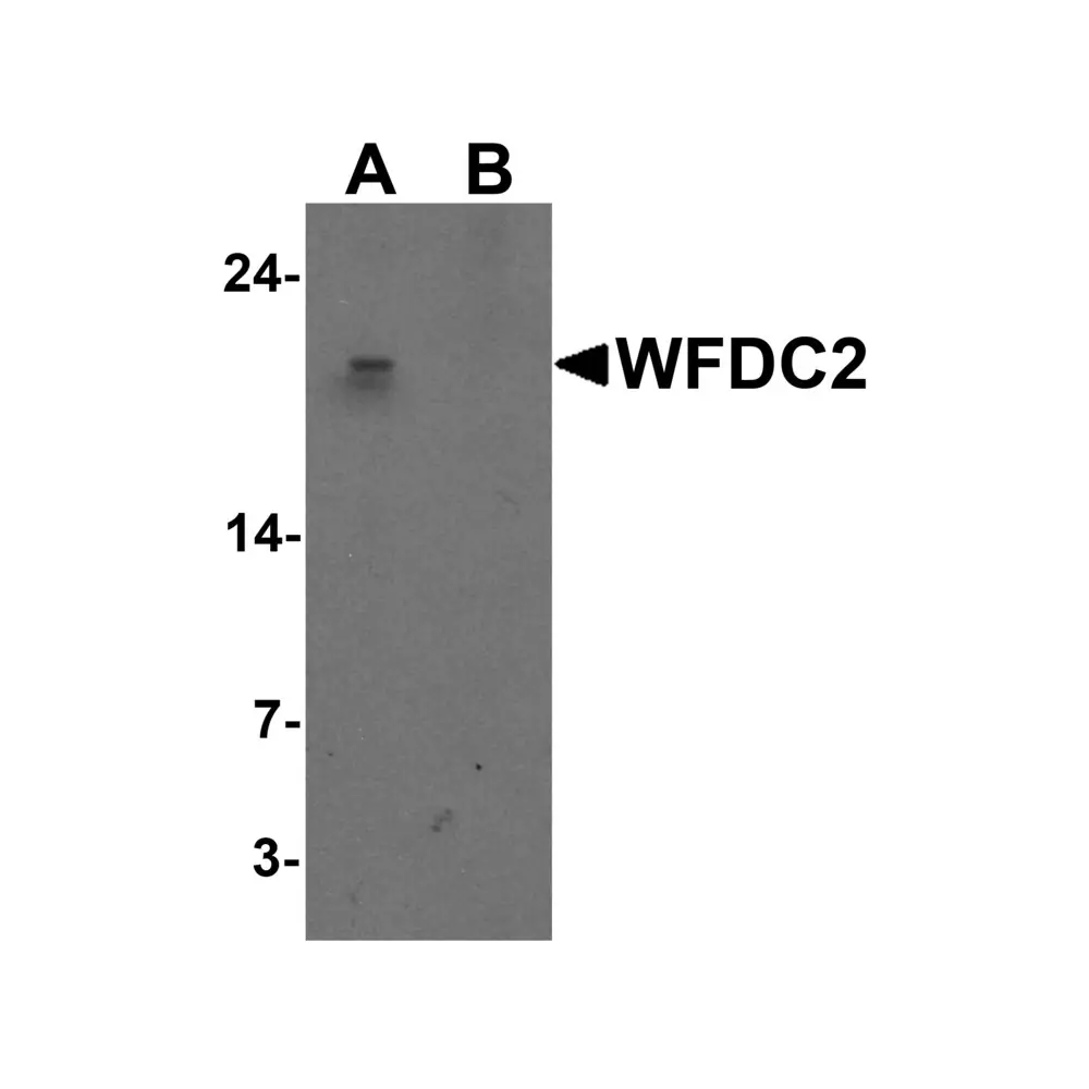 ProSci 7459 WFDC2 Antibody , ProSci, 0.1 mg/Unit Primary Image