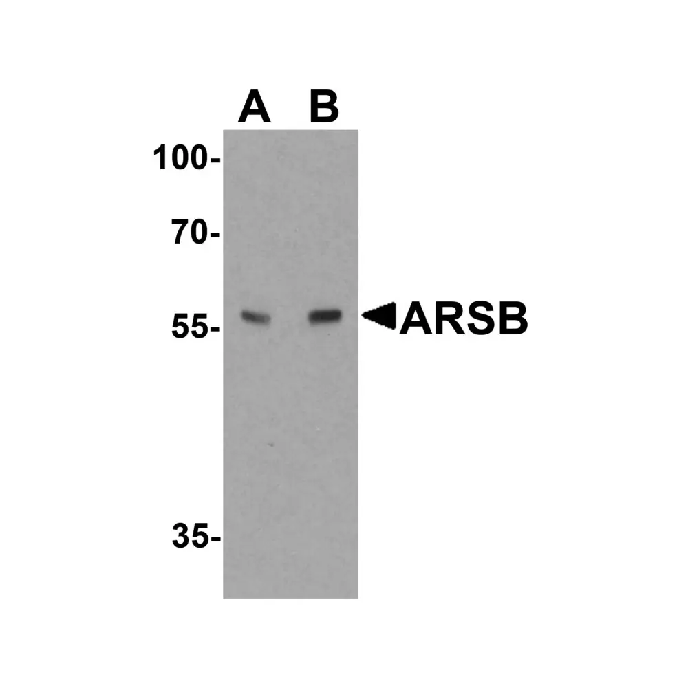 ProSci 7465 ARSB Antibody , ProSci, 0.1 mg/Unit Primary Image