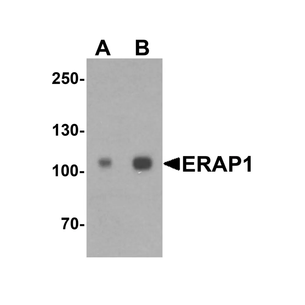 ProSci 7467 ERAP1 Antibody , ProSci, 0.1 mg/Unit Primary Image