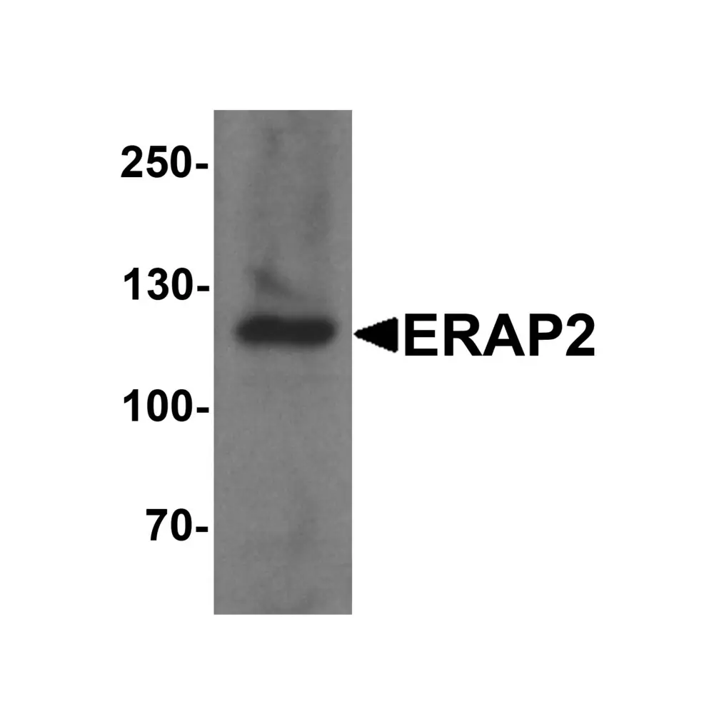 ProSci 7469_S ERAP2 Antibody , ProSci, 0.02 mg/Unit Primary Image