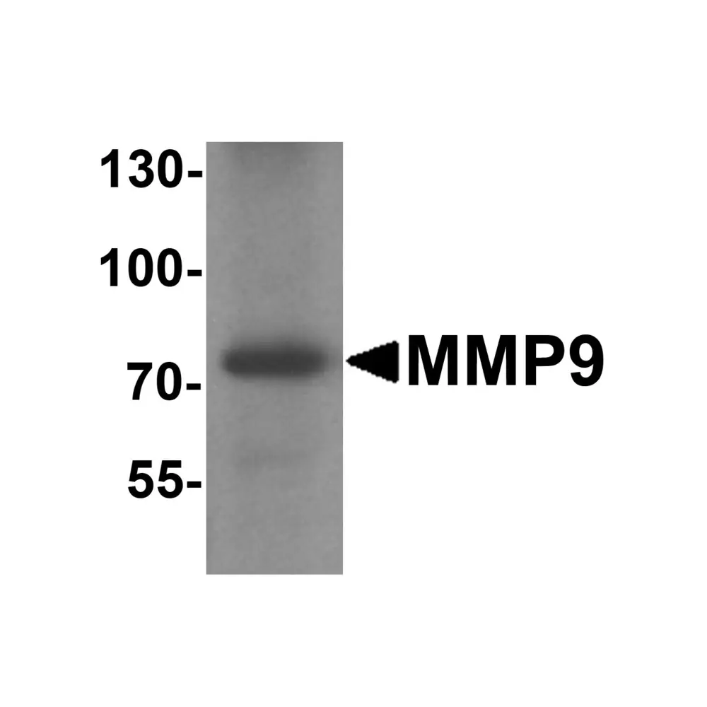 ProSci 7471_S MMP9 Antibody , ProSci, 0.02 mg/Unit Primary Image