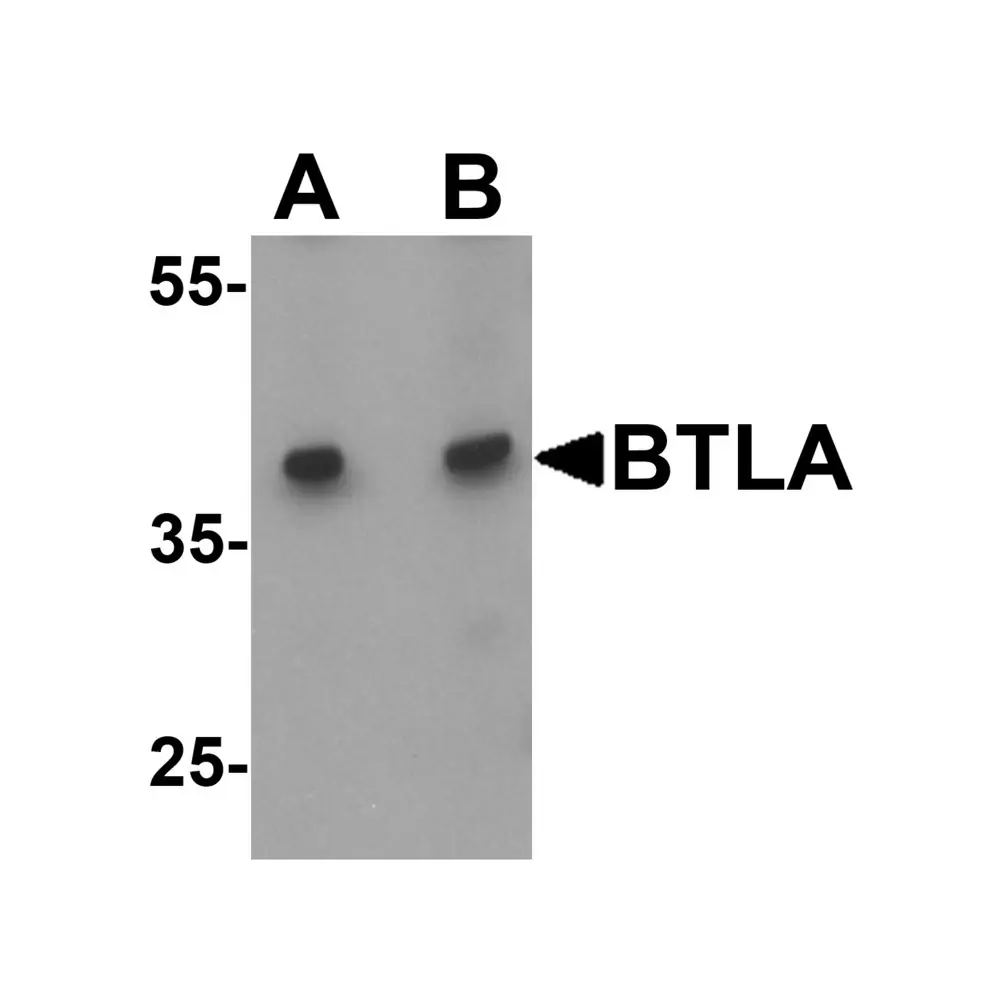 ProSci 7473 BTLA Antibody , ProSci, 0.1 mg/Unit Primary Image