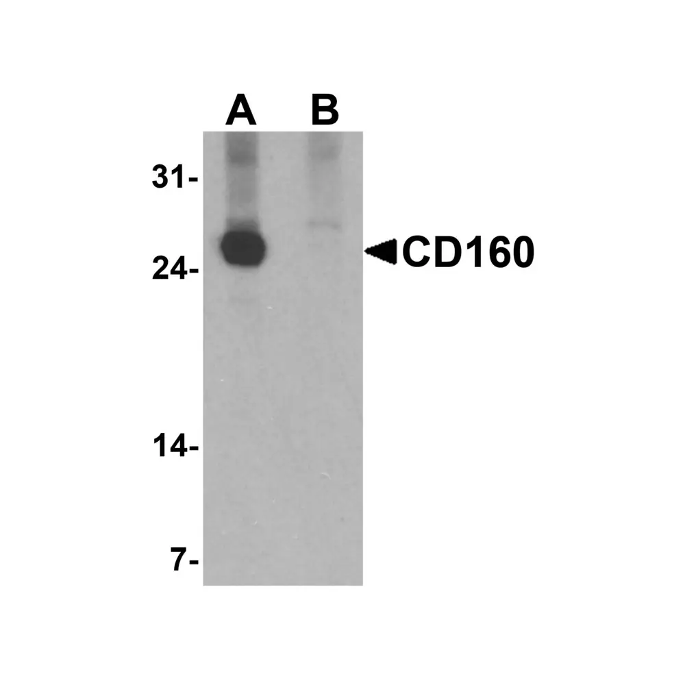 ProSci 7475 CD160 Antibody , ProSci, 0.1 mg/Unit Primary Image