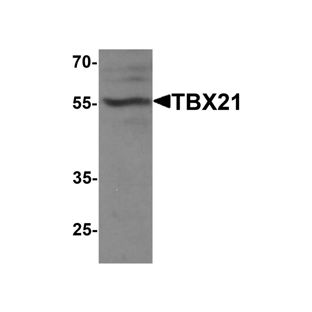 ProSci 7477_S TBX21 Antibody , ProSci, 0.02 mg/Unit Primary Image