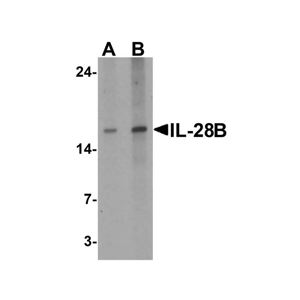 ProSci 7479 IL-28B Antibody , ProSci, 0.1 mg/Unit Primary Image