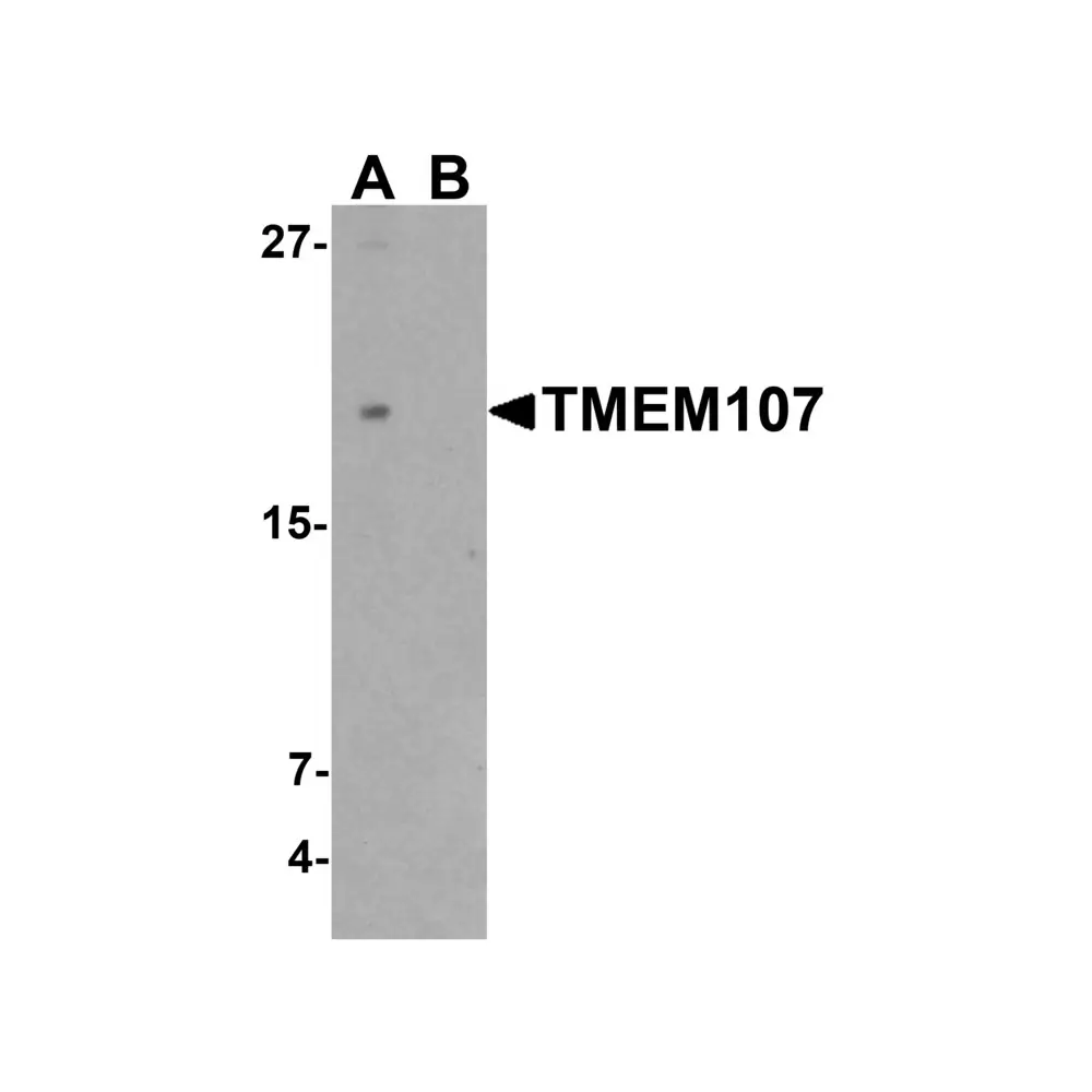 ProSci 7483 TMEM107 Antibody , ProSci, 0.1 mg/Unit Primary Image