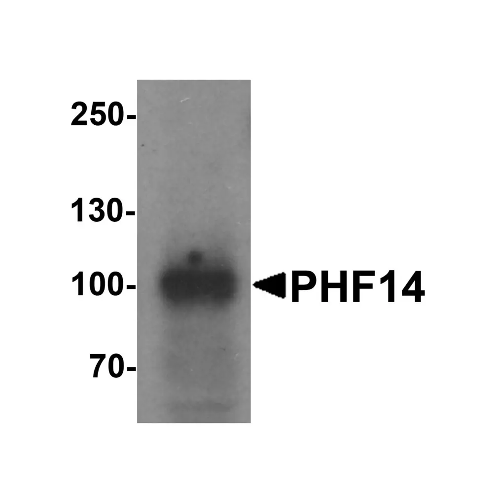 ProSci 7485_S PHF14 Antibody , ProSci, 0.02 mg/Unit Primary Image
