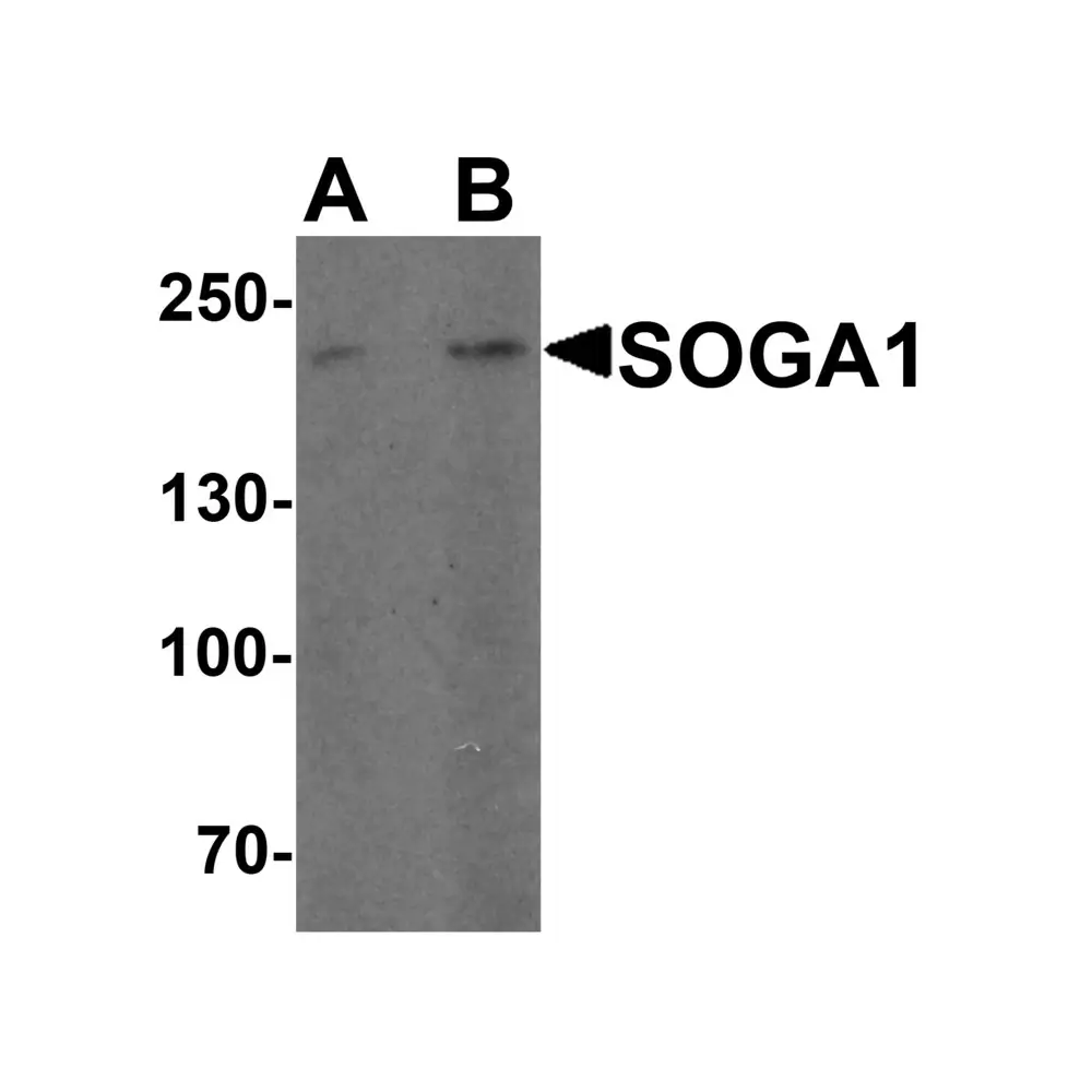 ProSci 7487 SOGA1 Antibody , ProSci, 0.1 mg/Unit Primary Image