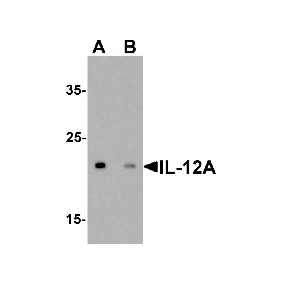 ProSci 7497 IL-12A Antibody, ProSci, 0.1 mg/Unit Primary Image
