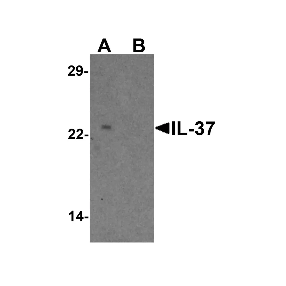 ProSci 7499_S IL-37 Antibody , ProSci, 0.02 mg/Unit Primary Image