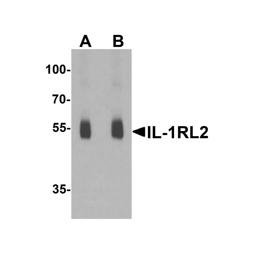 ProSci 7501_S IL-1RL2 Antibody, ProSci, 0.02 mg/Unit Primary Image