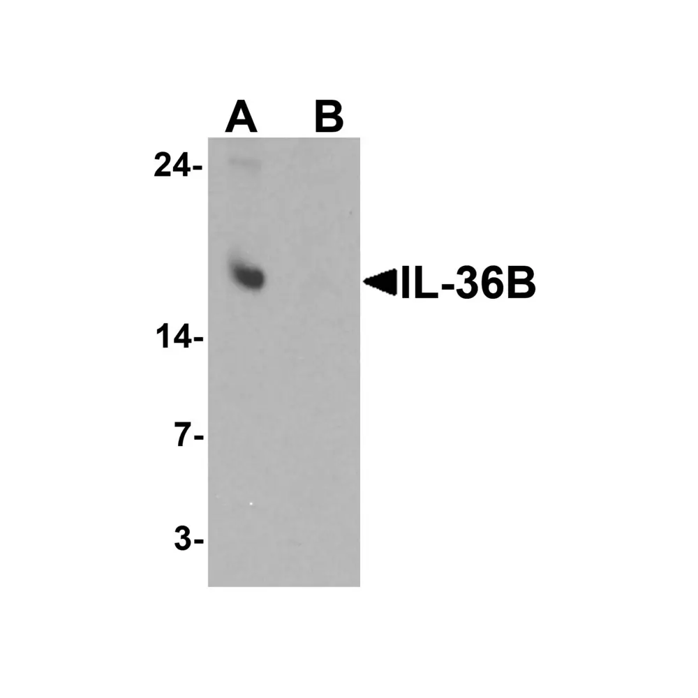 ProSci 7507_S IL-36B Antibody, ProSci, 0.02 mg/Unit Primary Image