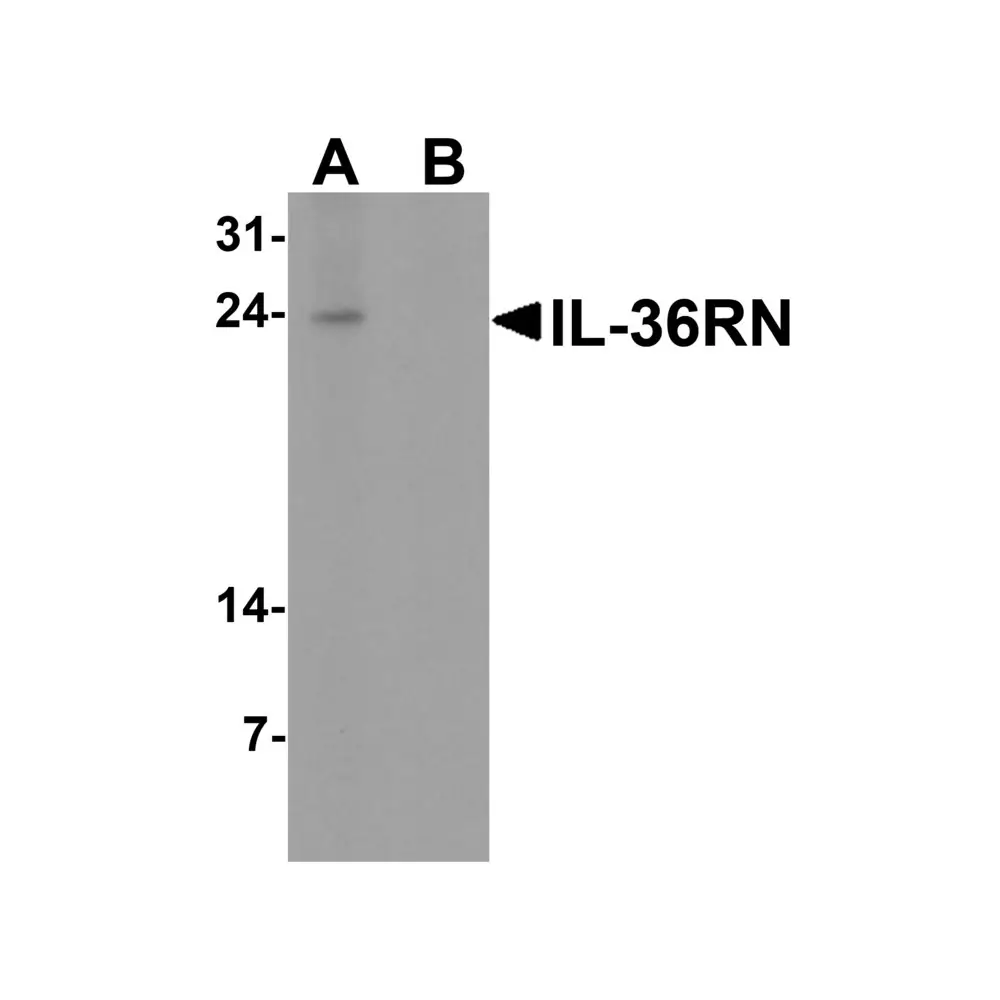 ProSci 7511 IL-36RN Antibody, ProSci, 0.1 mg/Unit Primary Image