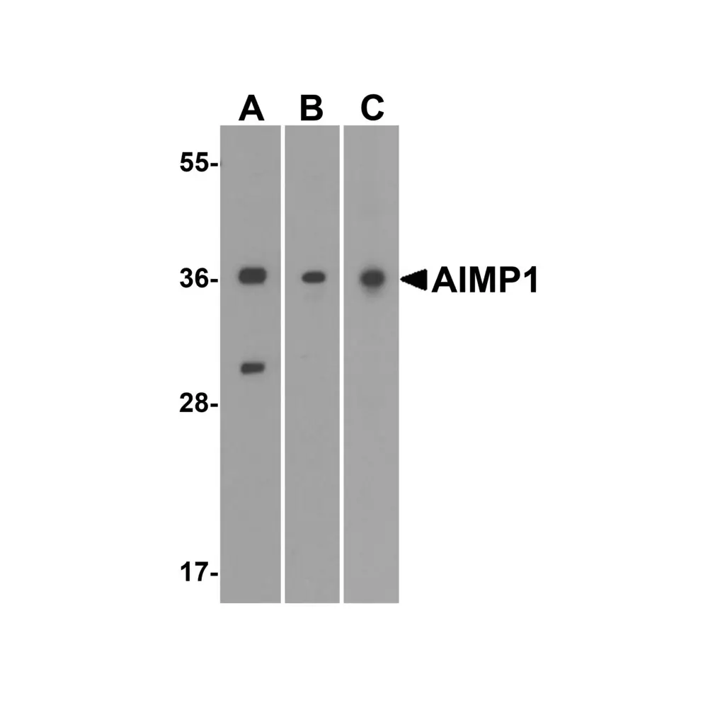 ProSci 7513 AIMP1 Antibody, ProSci, 0.1 mg/Unit Primary Image