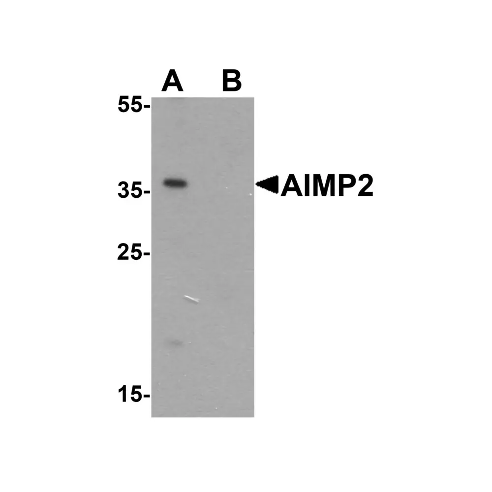 ProSci 7515 AIMP2 Antibody, ProSci, 0.1 mg/Unit Primary Image