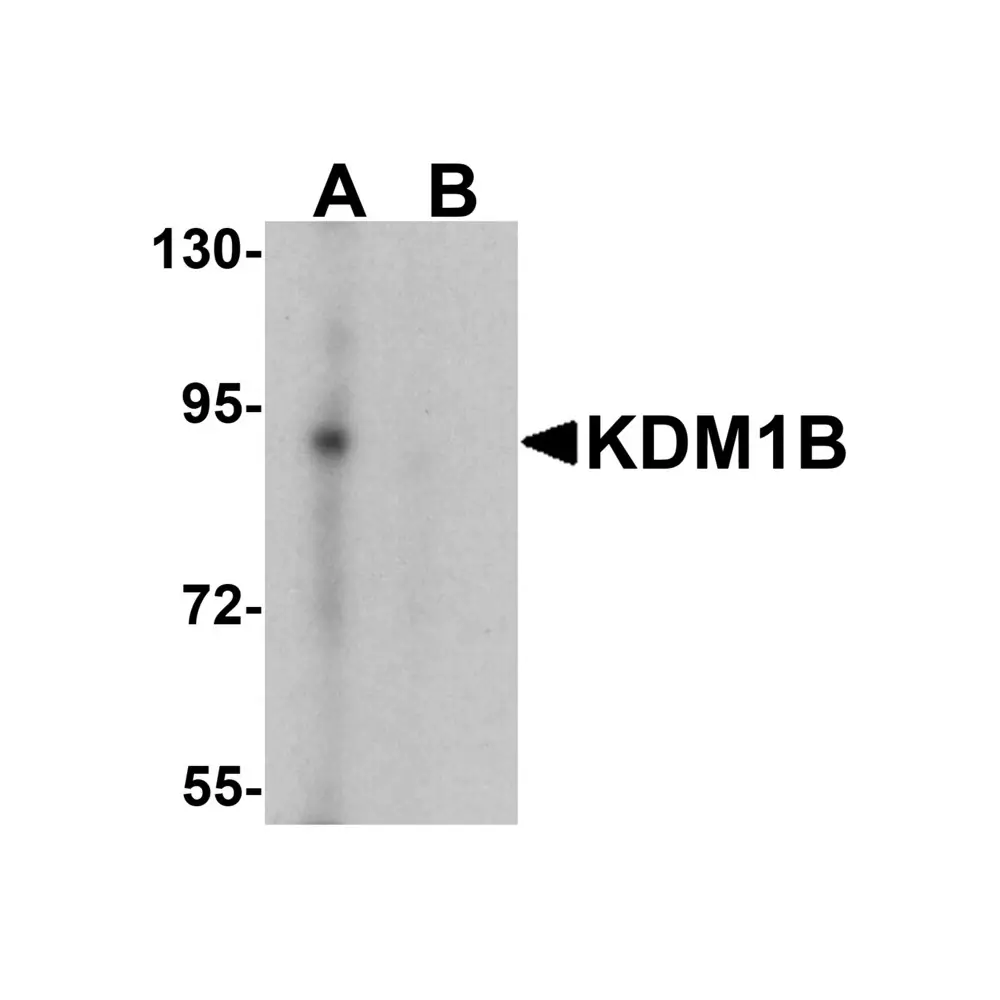 ProSci 7535 KDM1B Antibody, ProSci, 0.1 mg/Unit Primary Image