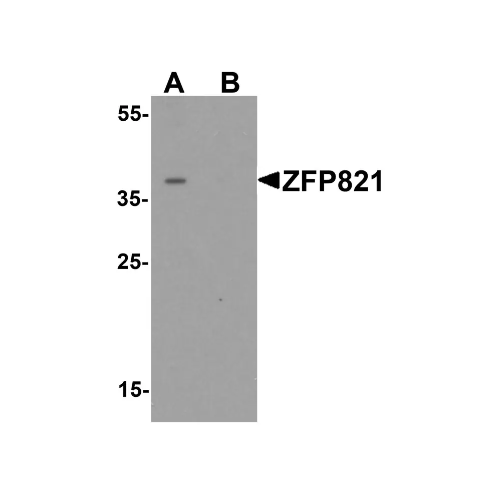 ProSci 7537 ZNF821 Antibody, ProSci, 0.1 mg/Unit Primary Image