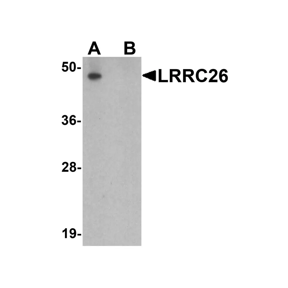ProSci 7539 LRRC26 Antibody, ProSci, 0.1 mg/Unit Primary Image