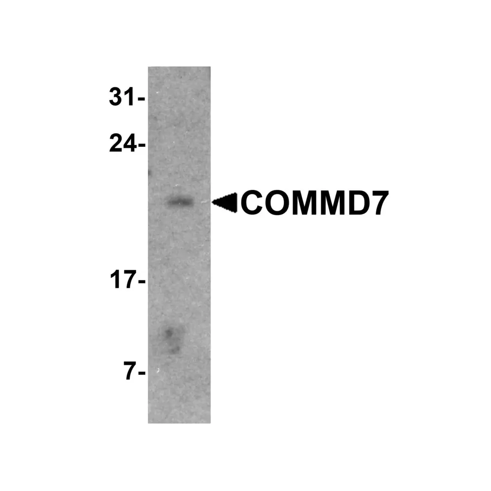 ProSci 7541_S COMMD7 Antibody, ProSci, 0.02 mg/Unit Primary Image