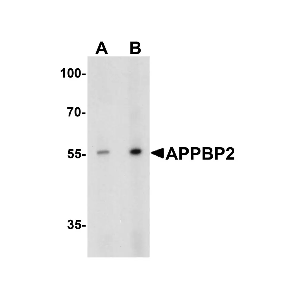 ProSci 7563_S APPBP2 Antibody, ProSci, 0.02 mg/Unit Primary Image