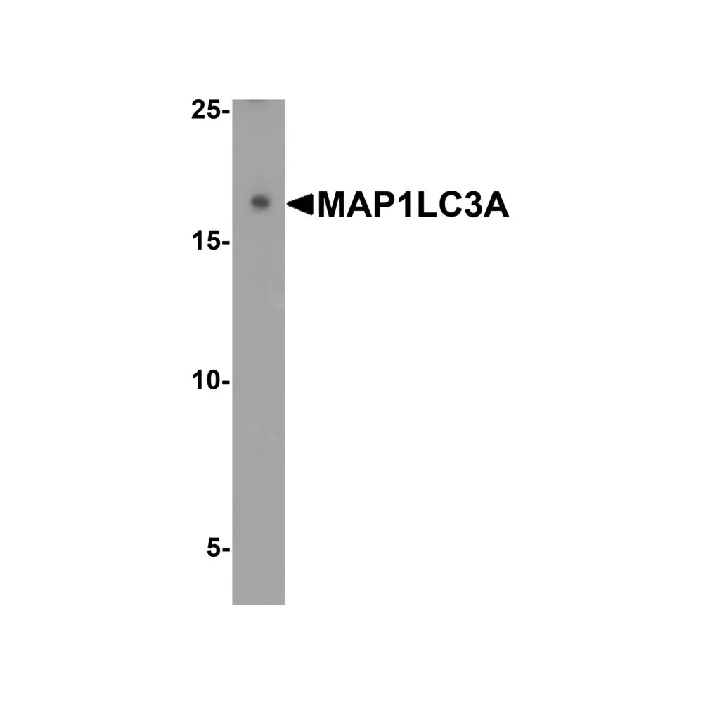 ProSci 7579 MAP1LC3A Antibody, ProSci, 0.1 mg/Unit Primary Image
