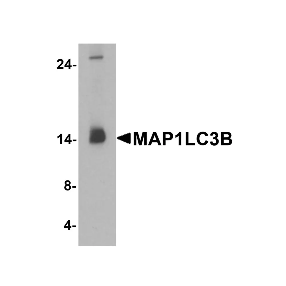 ProSci 7581 MAP1LC3B Antibody, ProSci, 0.1 mg/Unit Primary Image