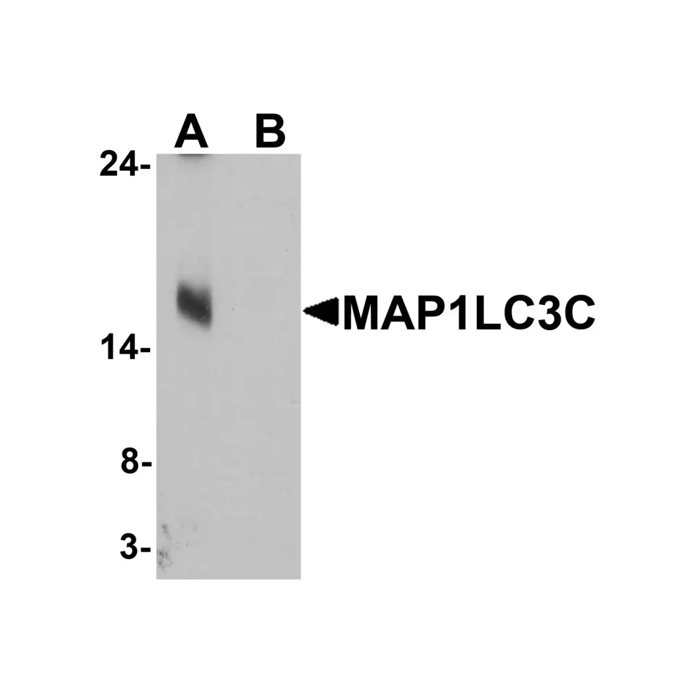 ProSci 7583_S MAP1LC3C Antibody, ProSci, 0.02 mg/Unit Primary Image