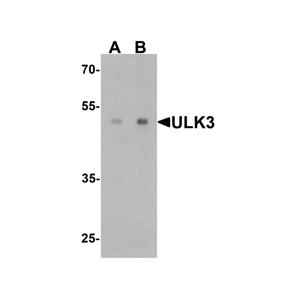 ProSci 7585 ULK3 Antibody, ProSci, 0.1 mg/Unit Primary Image