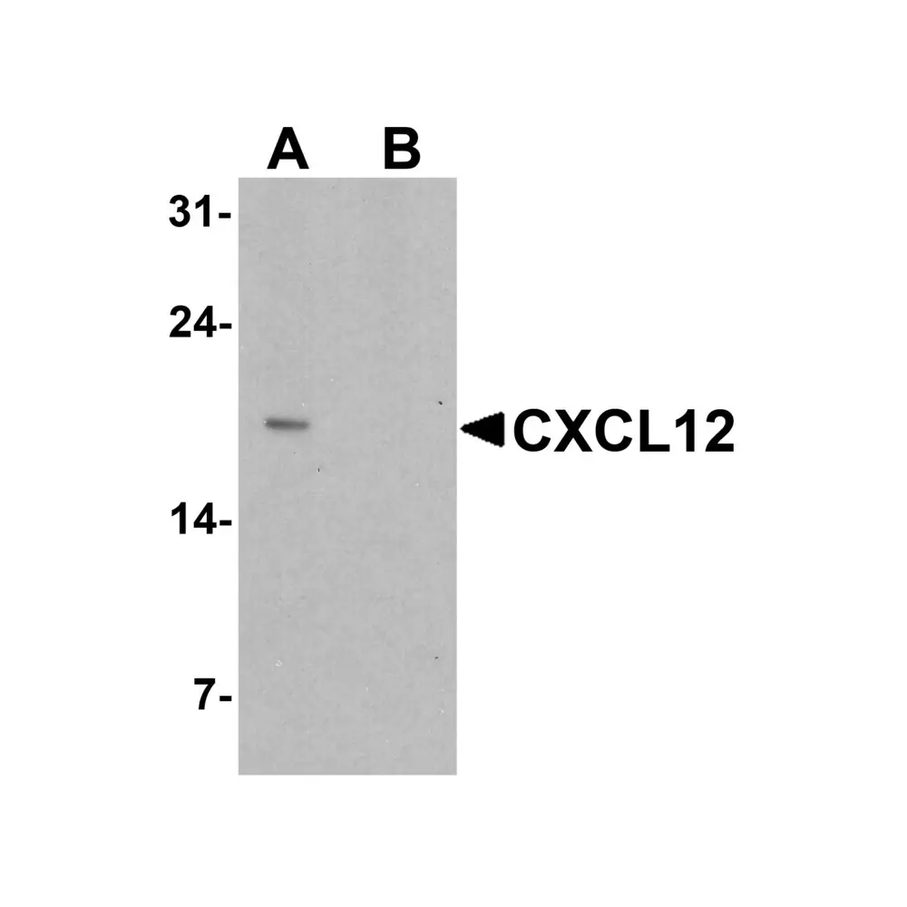 ProSci 7591_S CXCL12 Antibody, ProSci, 0.02 mg/Unit Primary Image