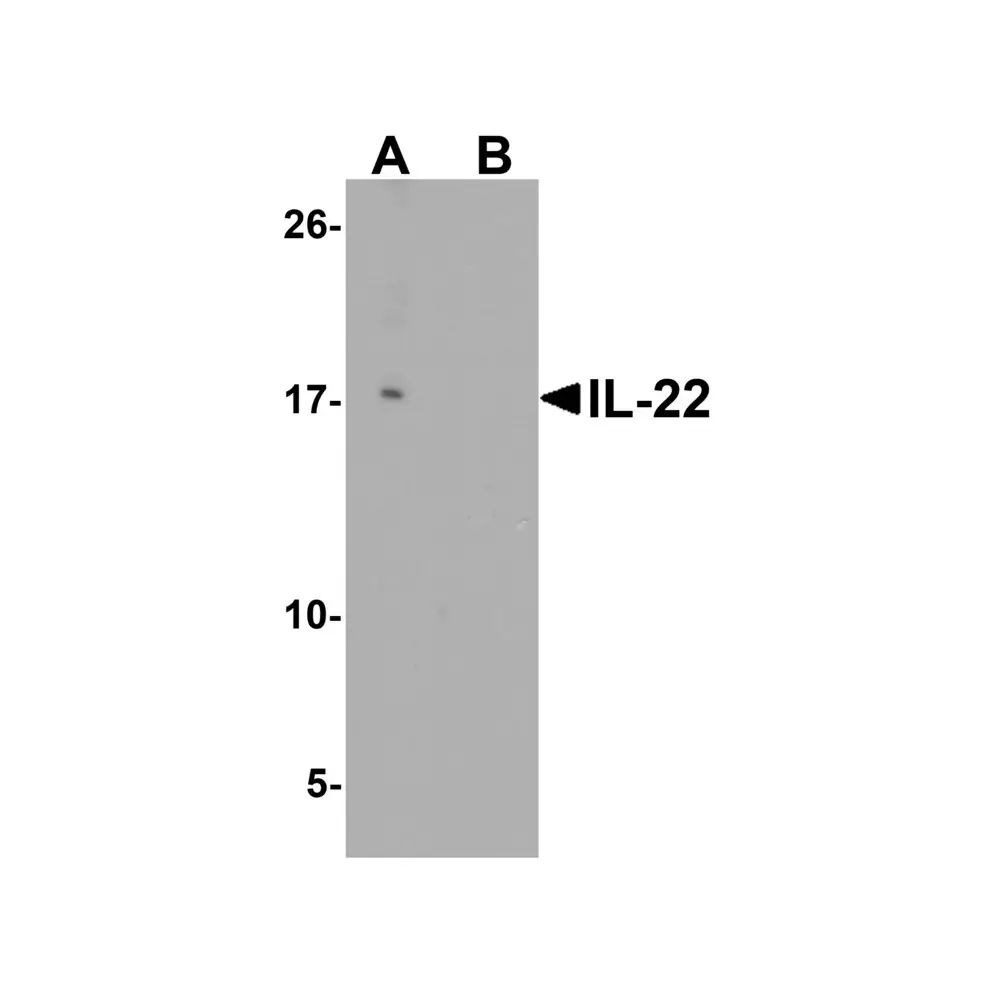 ProSci 7593 IL-22 Antibody, ProSci, 0.1 mg/Unit Primary Image