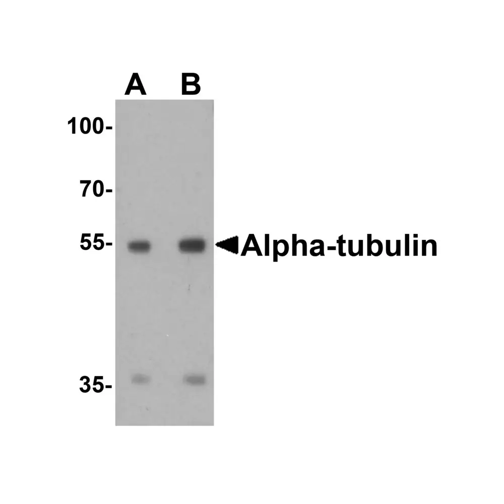 ProSci 7597 alpha-Tubulin Antibody, ProSci, 0.1 mg/Unit Primary Image