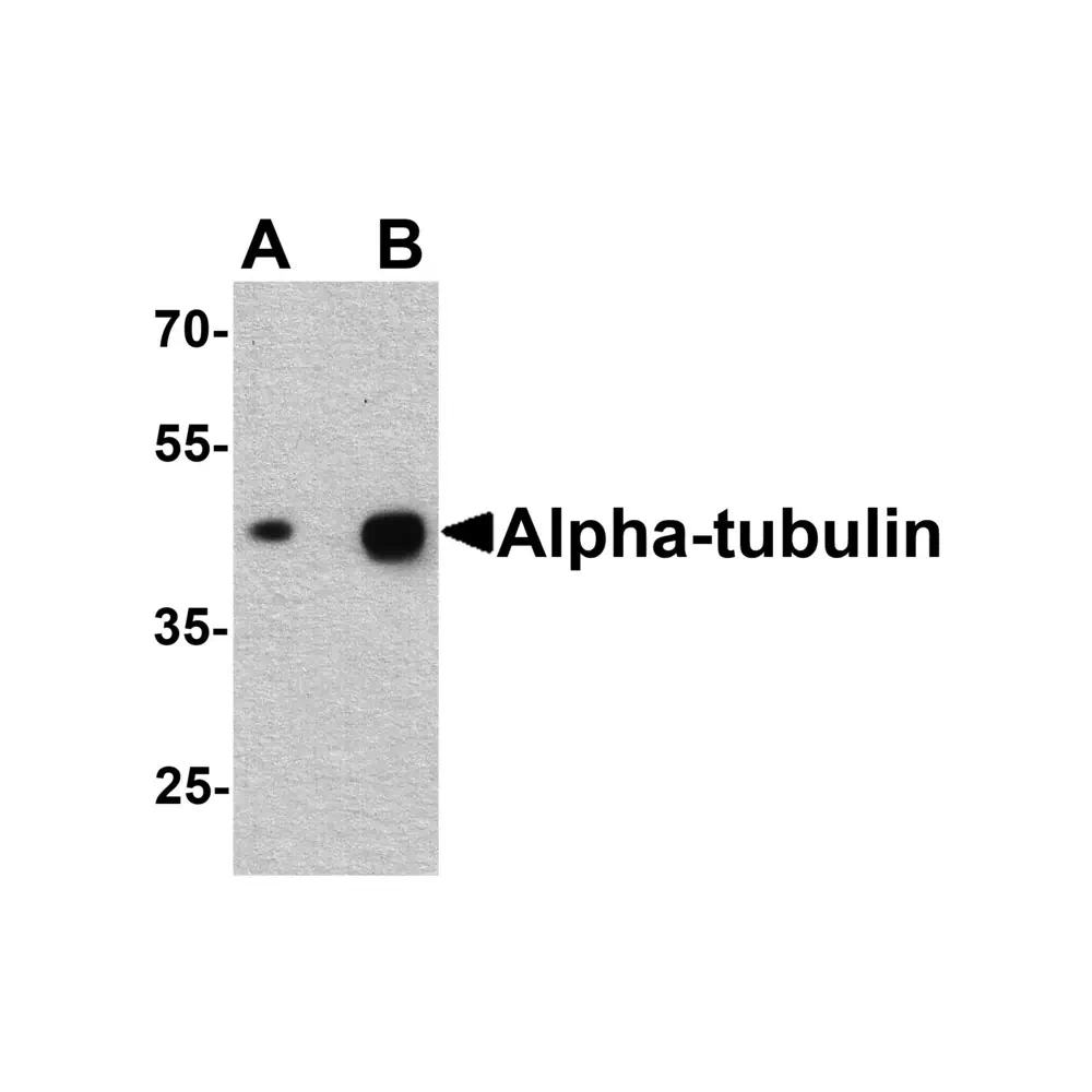 ProSci 7599 Alpha-tubulin Antibody, ProSci, 0.1 mg/Unit Primary Image