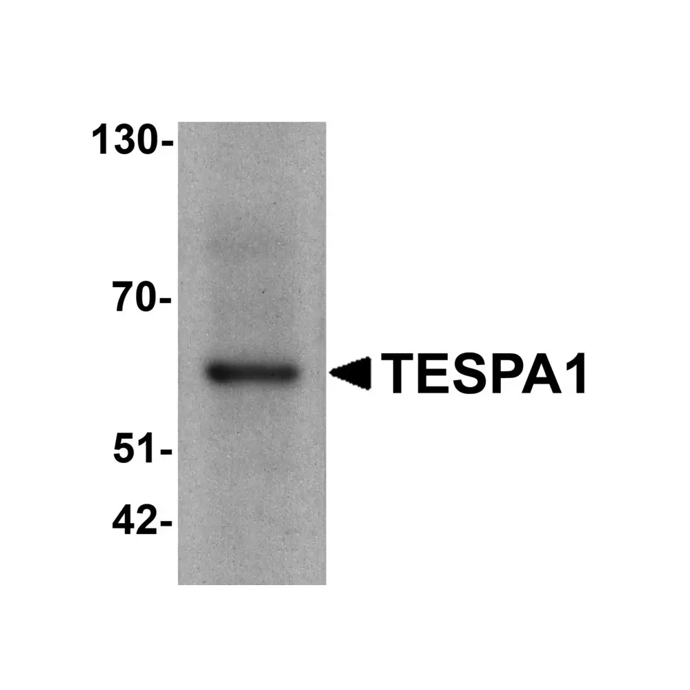 ProSci 7601 TESPA1 Antibody, ProSci, 0.1 mg/Unit Primary Image