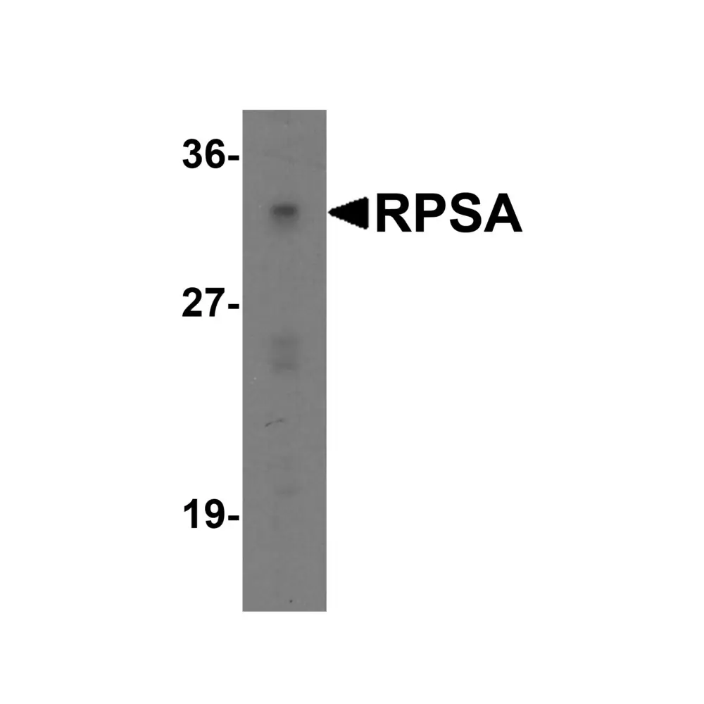 ProSci 7605_S RPSA Antibody, ProSci, 0.02 mg/Unit Primary Image