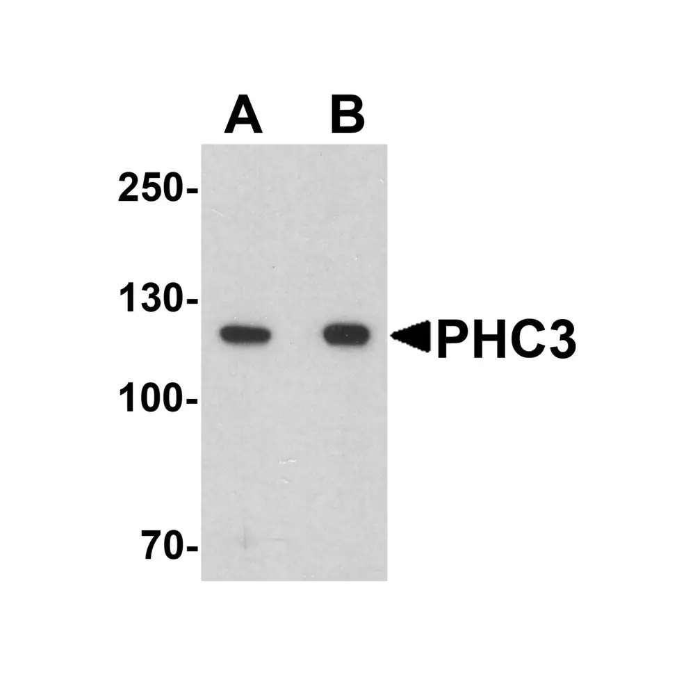 ProSci 7607_S PHC3 Antibody, ProSci, 0.02 mg/Unit Primary Image