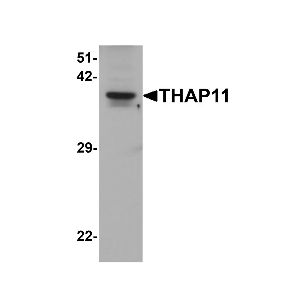 ProSci 7613 THAP11 Antibody, ProSci, 0.1 mg/Unit Primary Image