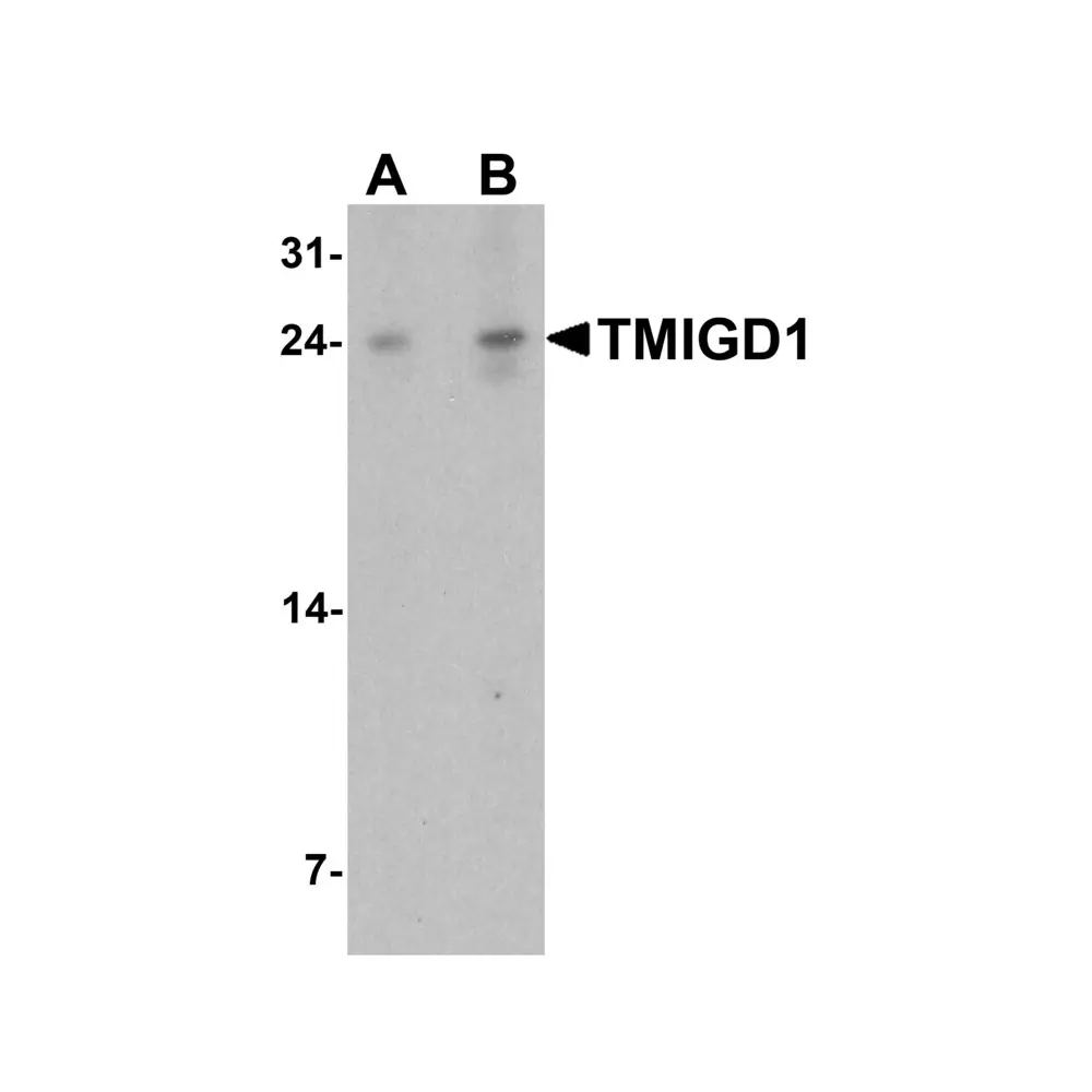 ProSci 7615_S TMIGD1 Antibody, ProSci, 0.02 mg/Unit Primary Image
