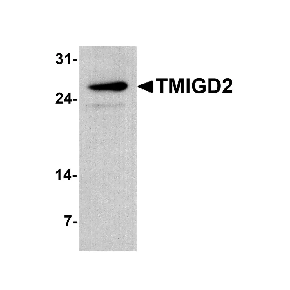 ProSci 7617_S TMIGD2 Antibody, ProSci, 0.02 mg/Unit Primary Image